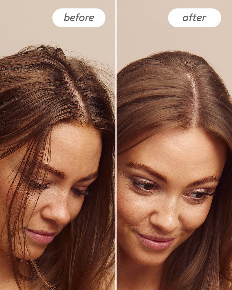 Scalp Delight™ Detox Conditioner - Image 4